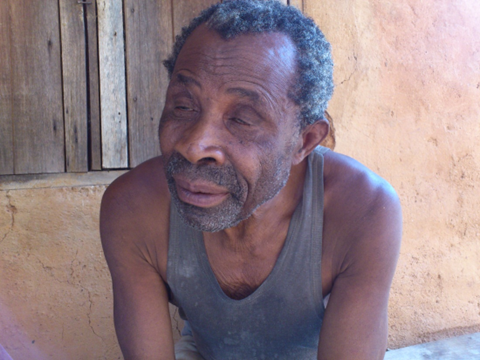 Pa Moses is a Cameroonian born in 1947, of age 72 and has been diagnosed with Cataract.  It all started at the age of 30. Before then, he was working as a Cook for a minister and later, he was taking care of the farm of another official. But the problem started after he had stopped these works and came back to Bamenda from the West where he was working. He is all alone, he cooks for himself and manages to survive. When his neighbor has, he shares with him. He learned how to do painting for a living but right now, he cannot do painting, much less anything because of his sight